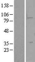 LYPD5 Human Over-expression Lysates NM_182573