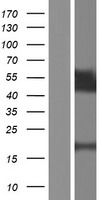 ls284355 tprx1 human over expression lysates nm 198479 wb testing 1