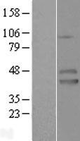 IZUMO1 Human Over-expression Lysates NM_182575