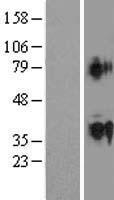 ls284382 actl9 human over expression lysates nm 178525 wb testing 1