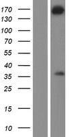 ls284403 wdr62 human over expression lysates nm 001083961 wb testing 1