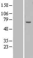 ls284406 znf545 zfp82 human over expression lysates nm 133466 wb testing 1