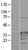 ODF3L2 Human Over-expression Lysates NM_182577