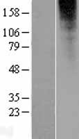 ls284521 or2l13 human over expression lysates nm 175911 wb testing 1