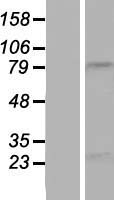 ls284565 nbpf15 human over expression lysates nm 173638 wb testing 1