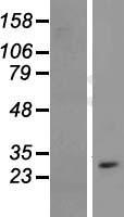 CYB561D1 Human Over-expression Lysates NM_182580