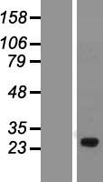 SPATA46 Human Over-expression Lysates NM_182581