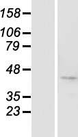 ls284697 btbd8 human over expression lysates nm 183242 wb testing 1