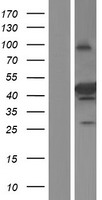 SEC14L4 Human Over-expression Lysates NM_001161368