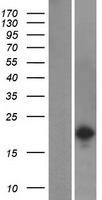 ls284948 sh2d6 human over expression lysates nm 198482 wb testing 1