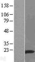 RNF149 Human Over-expression Lysates NM_173647