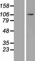 ls285025 ccdc141 human over expression lysates nm 173648 wb testing 1