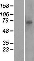 CXXC11 (RTP5) Human Over-expression Lysates NM_173821