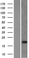 ls285193 dusp28 human over expression lysates nm 001033575 wb testing 1