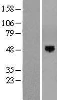 AER61 (EOGT) Human Over-expression Lysates NM_173654