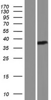 Eph receptor A6 (EPHA6) Human Over-expression Lysates NM_173655