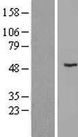 ls285268 znf621 human over expression lysates nm 198484 wb testing 1