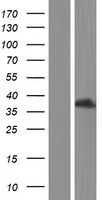 SUMF1 Human Over-expression Lysates NM_001164674