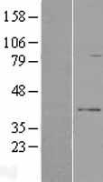RPUSD3 Human Over-expression Lysates NM_173659