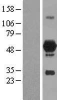 DOK7 Human Over-expression Lysates NM_173660