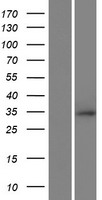 ls285498 loc285498 rnf212 human over expression lysates nm 001131034 wb testing 1