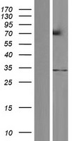 ls285498 loc285498 rnf212 human over expression lysates nm 001193318 wb testing 3