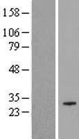 ls285521 cox18 human over expression lysates nm 173827 wb testing 1