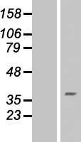 RING finger protein 175 (RNF175) Human Over-expression Lysates NM_173662
