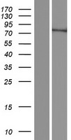 ls285550 fam200b human over expression lysates nm 001145191 wb testing 1