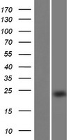 ls285588 efcab9 human over expression lysates nm 001171183 wb testing 1