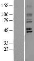 GPR 150 (GPR150) Human Over-expression Lysates NM_199243