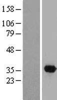 ls285605 dtwd2 human over expression lysates nm 173666 wb testing 1