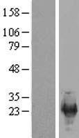 SFRS12IP1 (SREK1IP1) Human Over-expression Lysates NM_173829