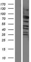 ls285753 c6orf182 cep57l1 human over expression lysates nm 001083535 wb testing 1