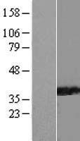 PPIL6 Human Over-expression Lysates NM_173672