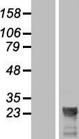 ls285908 ncrna00174 linc00174 human over expression lysates nm 181722 wb testing 1