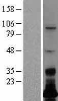 C7orf53 (LSMEM1) Human Over-expression Lysates NM_001134468