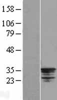 NSE2 (NSMCE2) Human Over-expression Lysates NM_173685