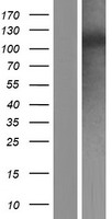 FBXO43 Human Over-expression Lysates NM_001029860