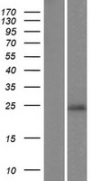 C9orf150 (LURAP1L) Human Over-expression Lysates NM_203403