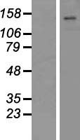 ATP11C Human Over-expression Lysates NM_173694