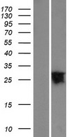 ls286451 yipf6 human over expression lysates nm 173834 wb testing 1