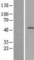 ls286464 cfap47 human over expression lysates nm 173695 wb testing 1