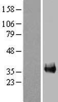 FAM133A Human Over-expression Lysates NM_173698