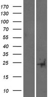 TRARG1 Human Over-expression Lysates NM_172367