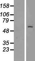 Cytokeratin 6C (KRT6C) Human Over-expression Lysates NM_173086