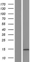 EIF4E3 Human Over-expression Lysates NM_173359