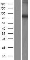 DDX51 Human Over-expression Lysates NM_175066