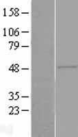 ZAR1 Human Over-expression Lysates NM_175619