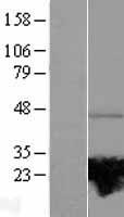 RAB37 Human Over-expression Lysates NM_001006638